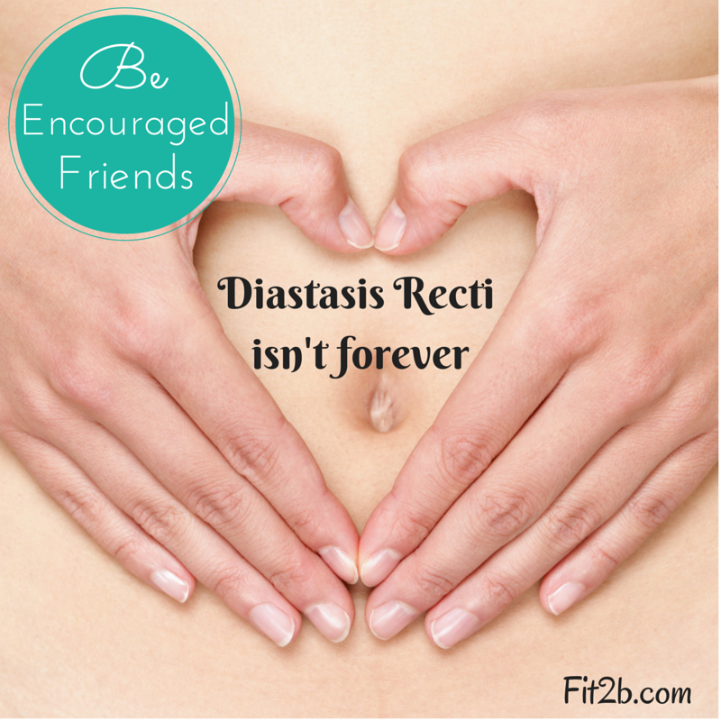 Diastasis recti in child