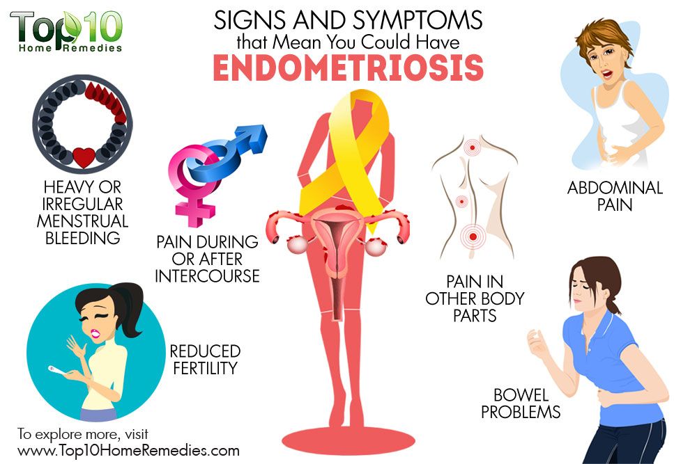 Pregnancy and pcos complications