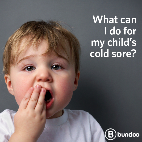 Baby cold sore pictures