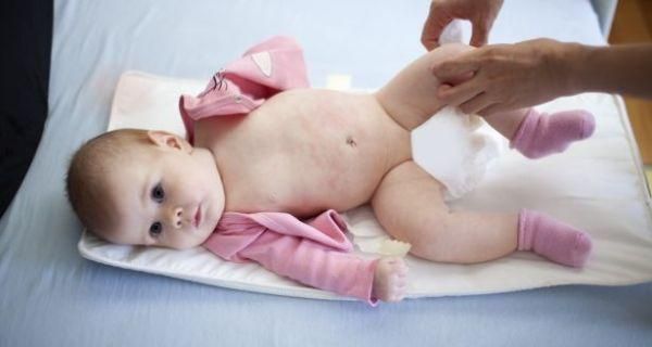 Red rash on newborn body