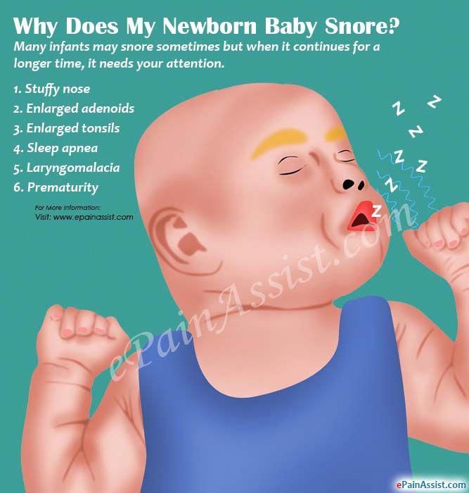 Causes of infant hiccups