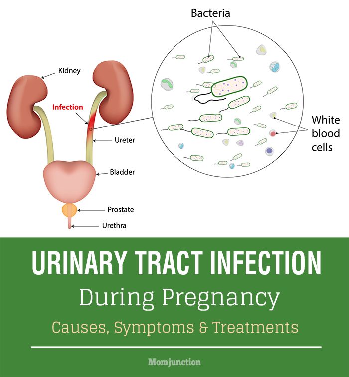 What can cause a yeast infection in pregnancy