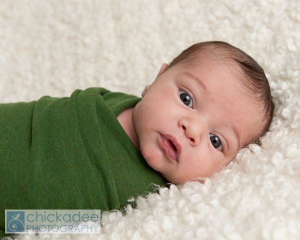 Swollen eye newborn babies