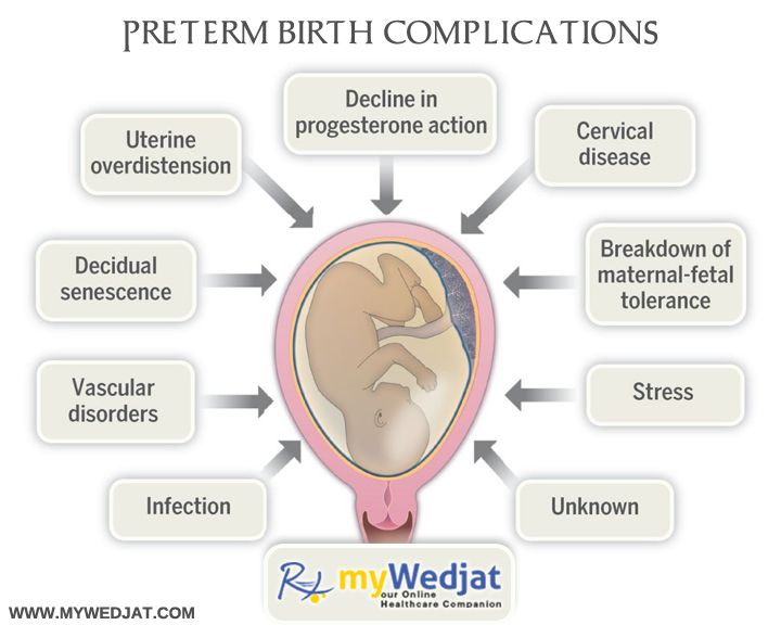 Painful uterus after birth