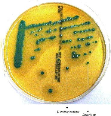 What are the odds of getting listeria while pregnant