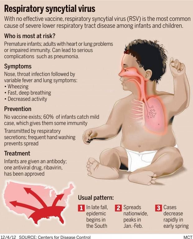 Projectile spit up in infants