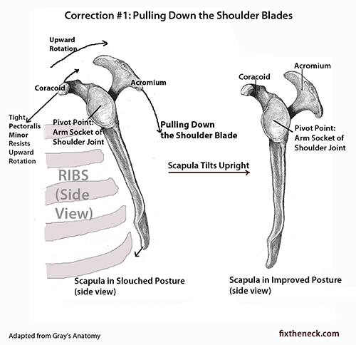 Shoulder blade pain early pregnancy