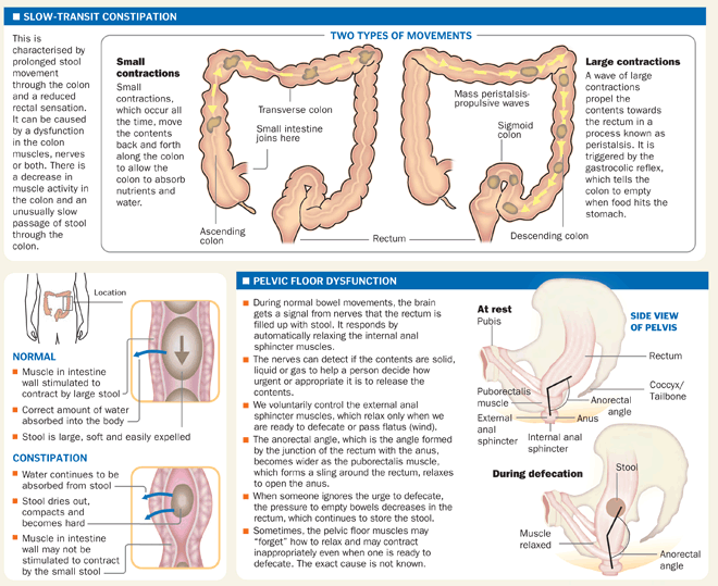 Easing contraction pain