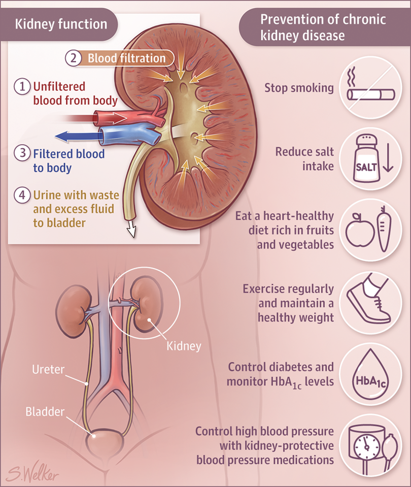 Infants urinary tract infection