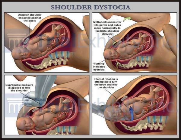 Labor and birth process