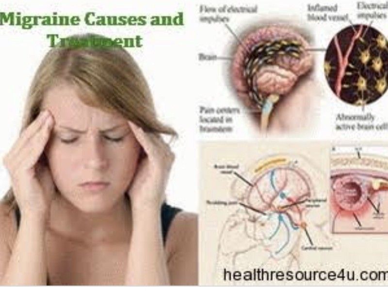 Migraine late pregnancy