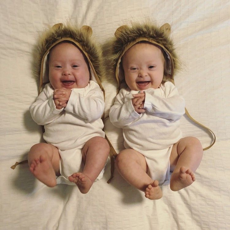 Can you have a natural birth with twins