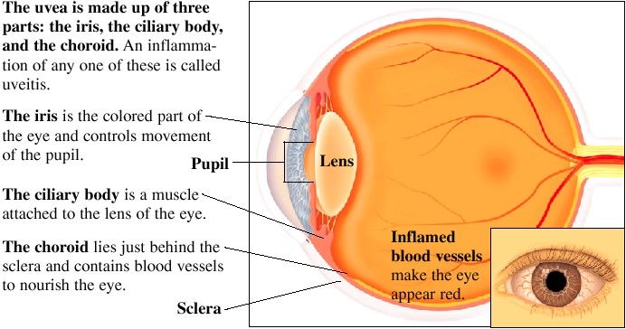 Infant eye infection yellow discharge