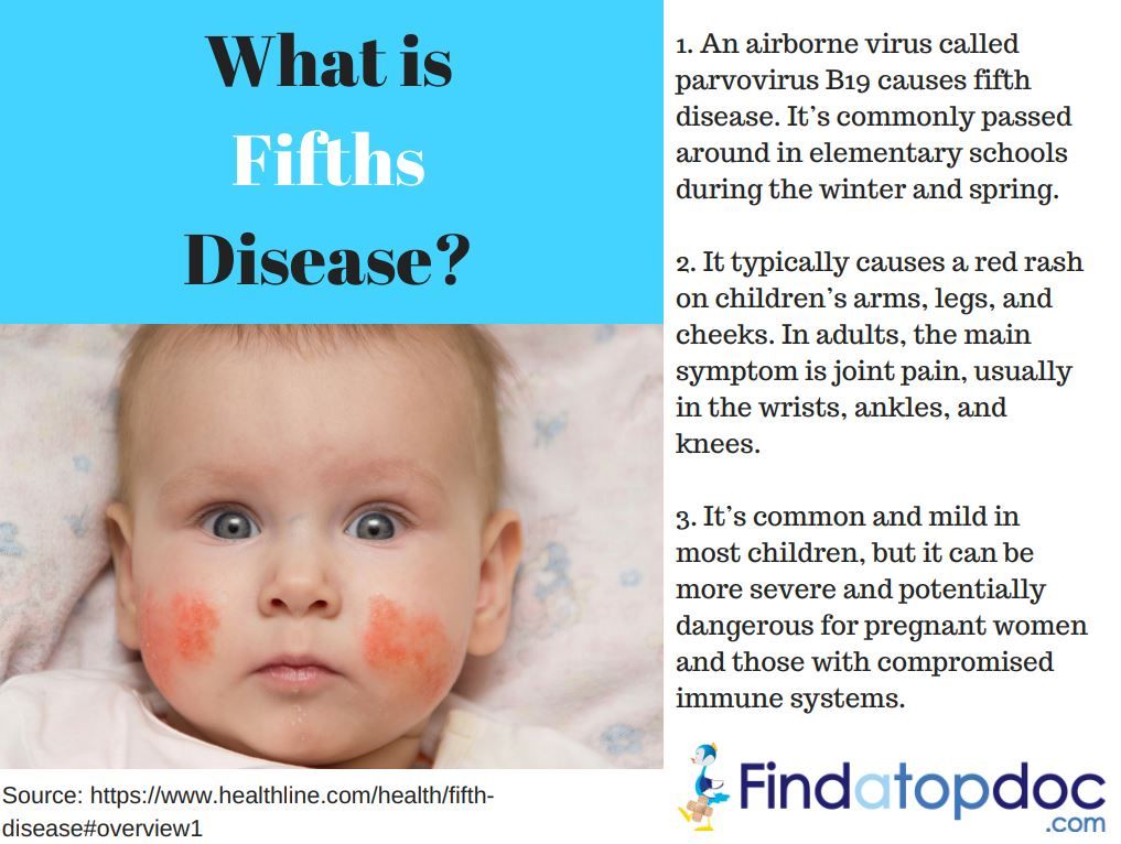 Rash on babies face around mouth