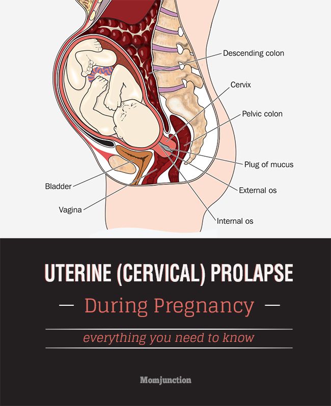 Cervical infections during pregnancy