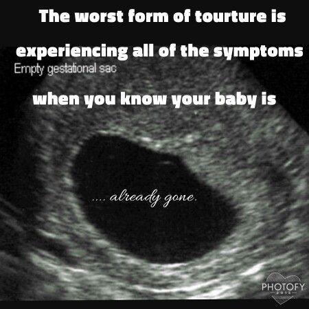 Miscarriage without knowing you were pregnant