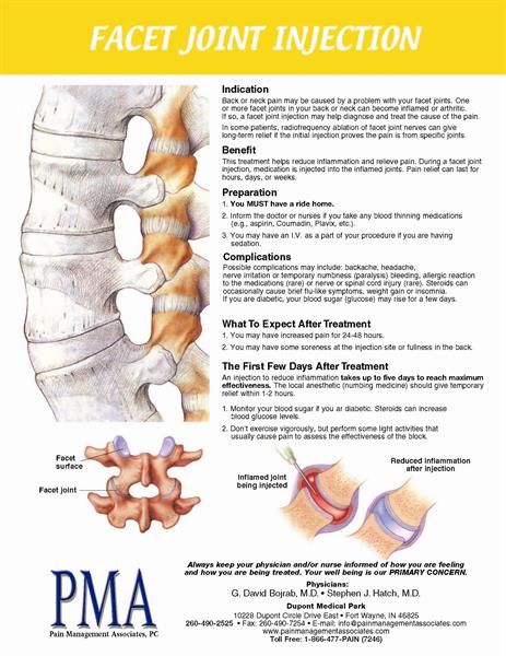 Non epidural pain relief labor