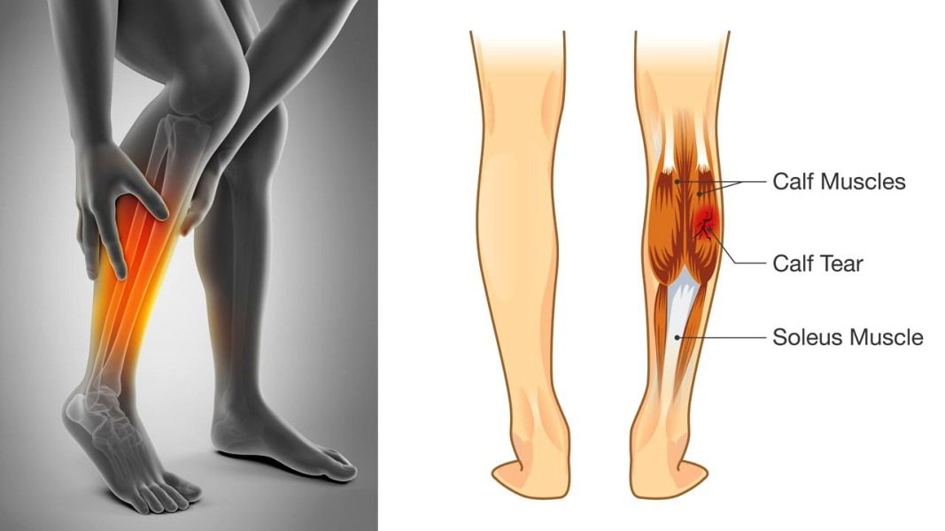 Causes of leg muscle spasms