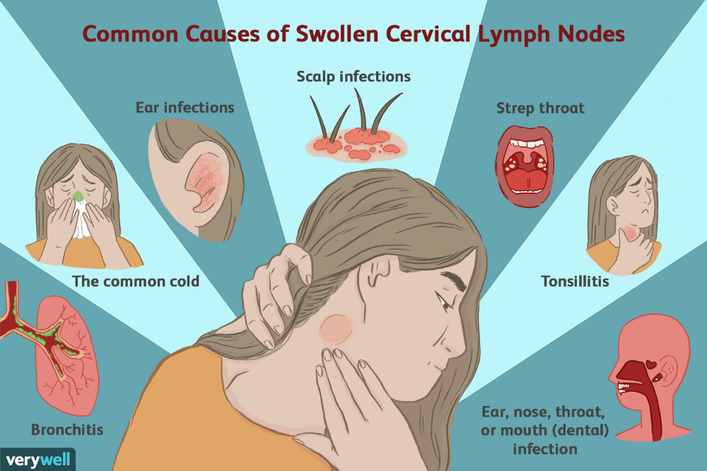 How to tell if child has strep throat