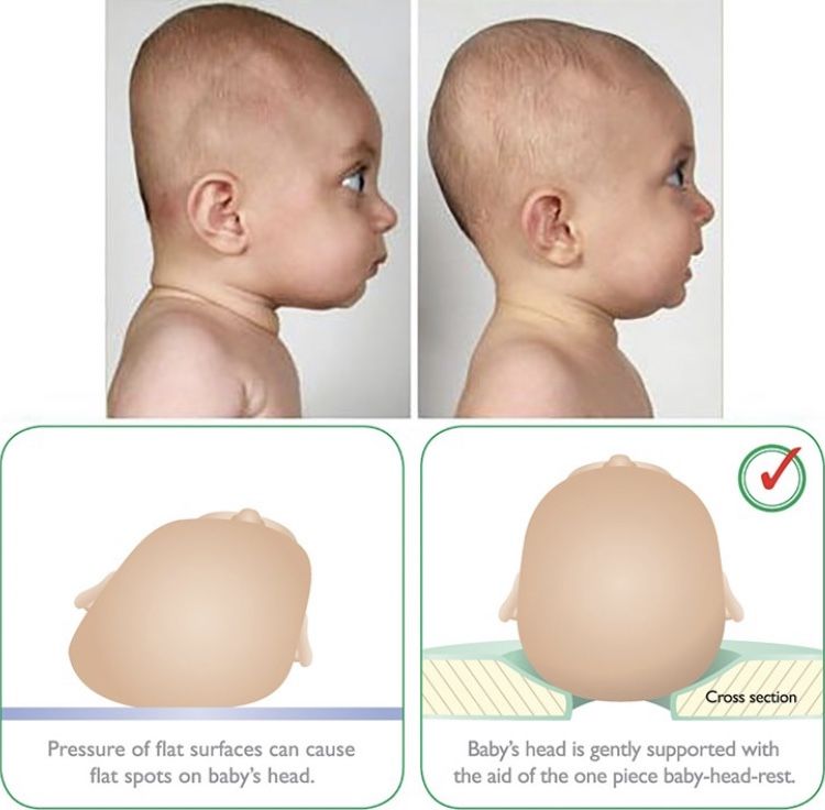 Baby skull not formed 12 weeks