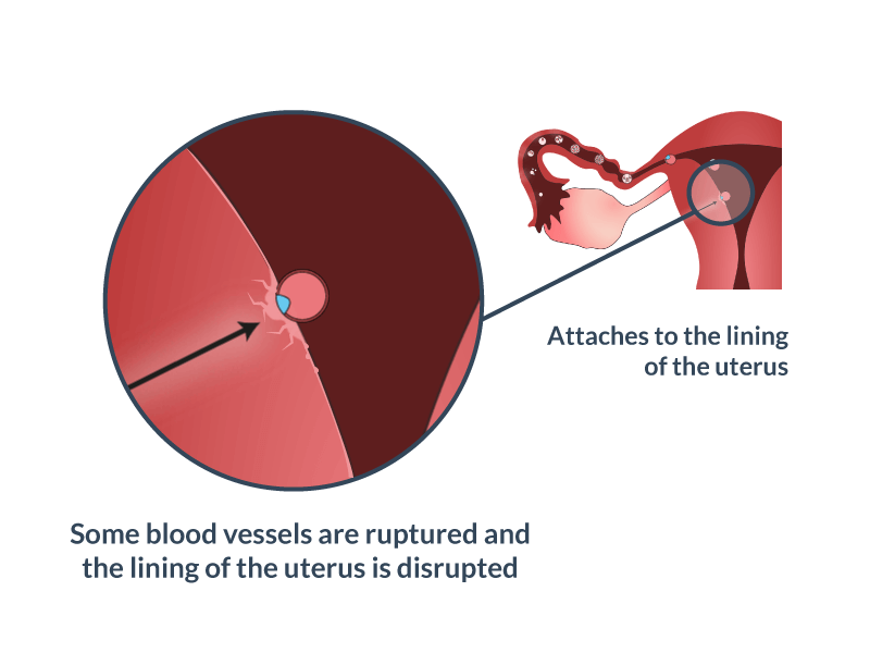 Location of the uterus during pregnancy