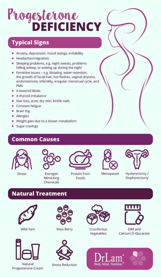 Migraine early pregnancy sign