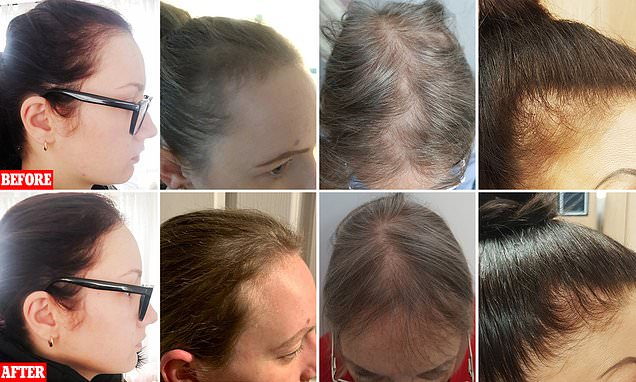 Hair growth during pregnancy before and after