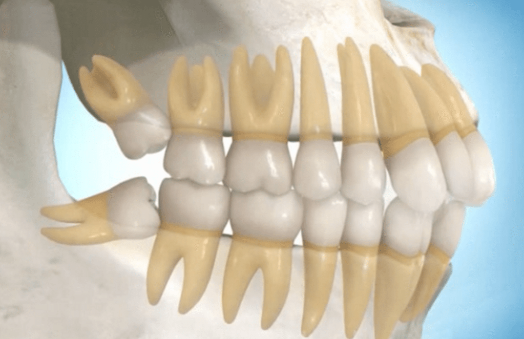 Molars growing in