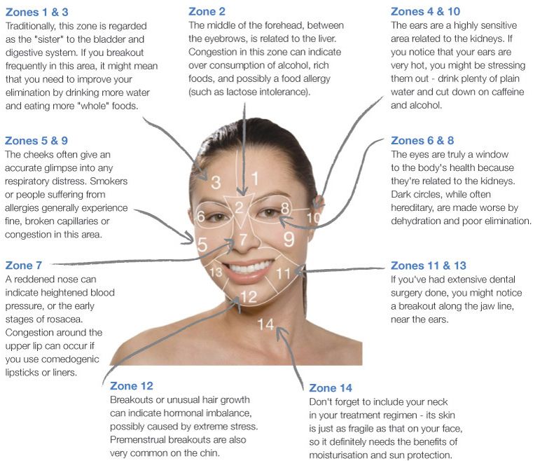 Lactose intolerance rash on face