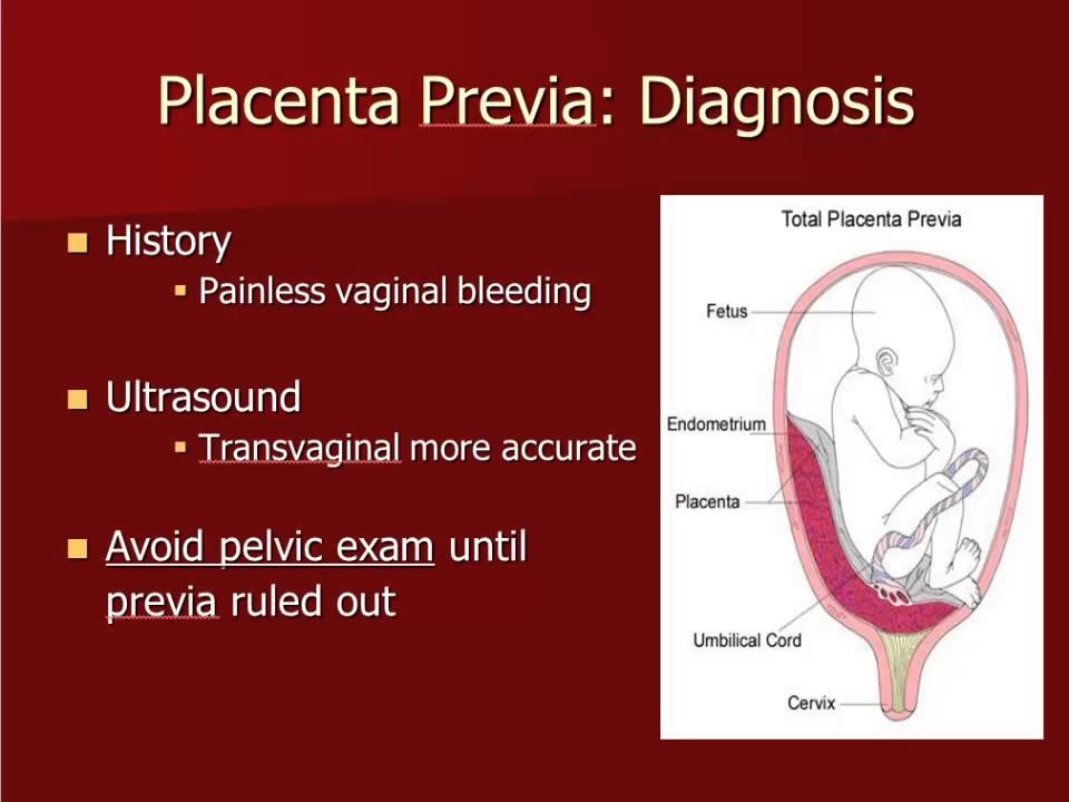 Fetal movement in 3rd trimester