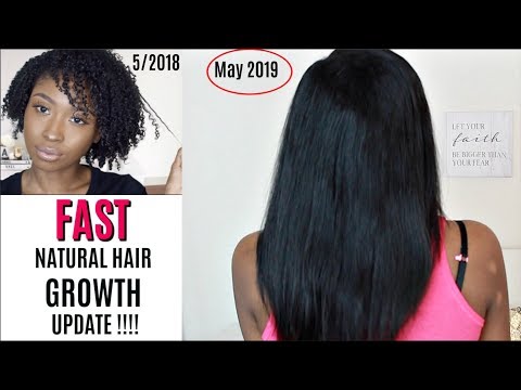 Prenatal hair growth before and after