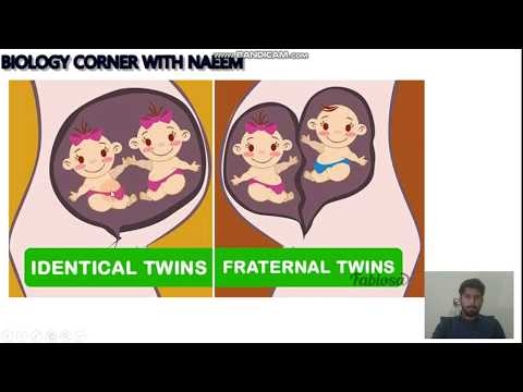 What is dizygotic twins