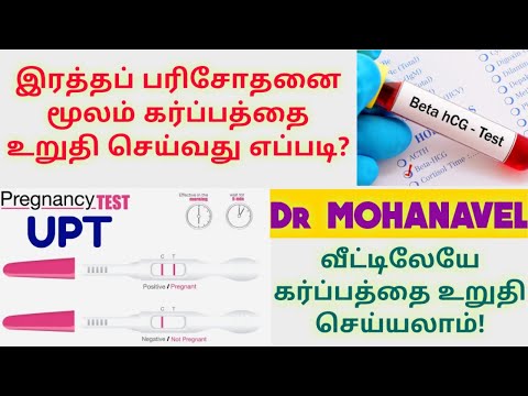 Doctors urine test pregnancy