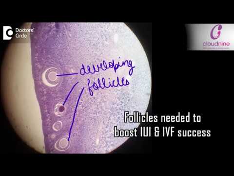 What is ivf for