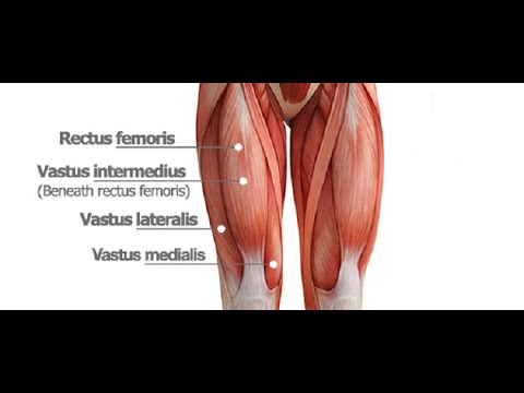 Rectus muscle separation