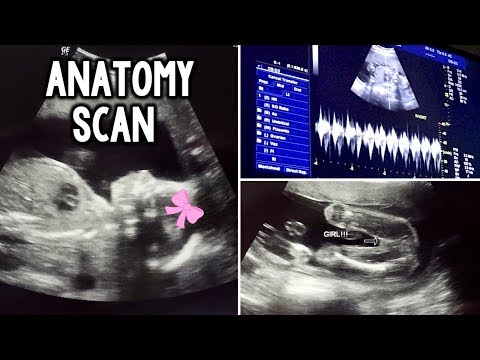 Ultrasound pregnancy scan