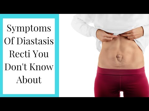 Diastasis recti what is it