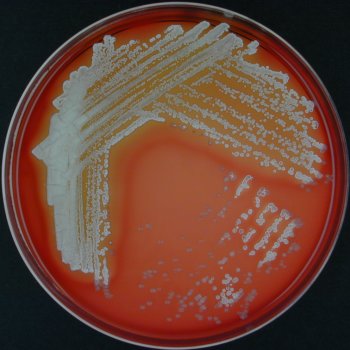 Sources of listeria