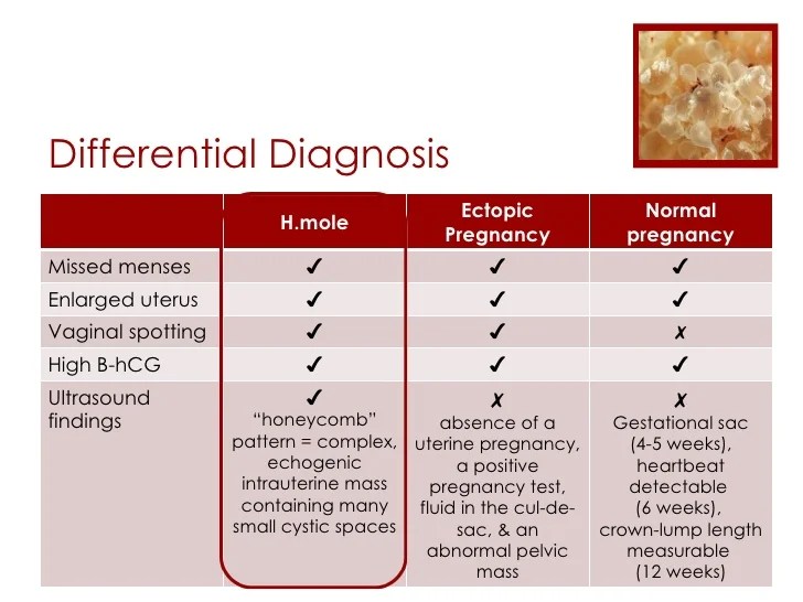 Is diarrhea a symptom of ectopic pregnancy