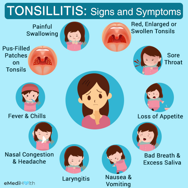 What causes vomiting in newborns