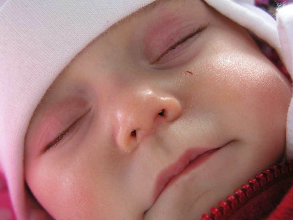 Infant eyelid redness