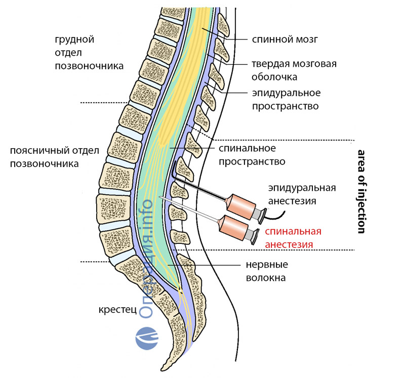 Baby spinal problems