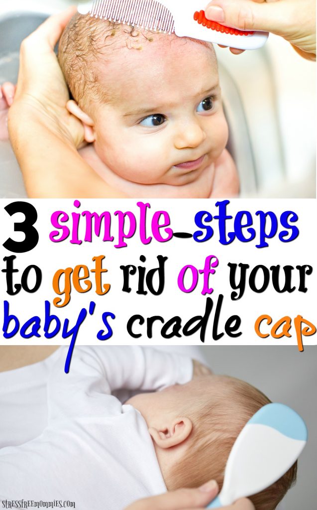 Cradle cap all over body