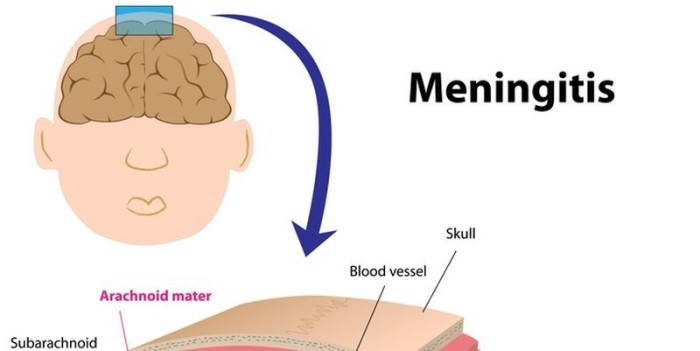 Newborn meningitis rash