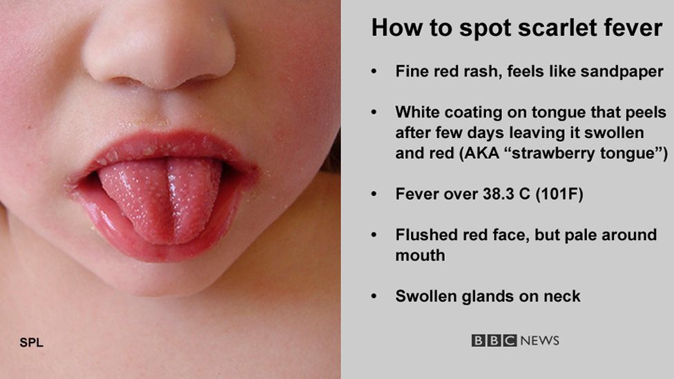 Pimple like rashes in children