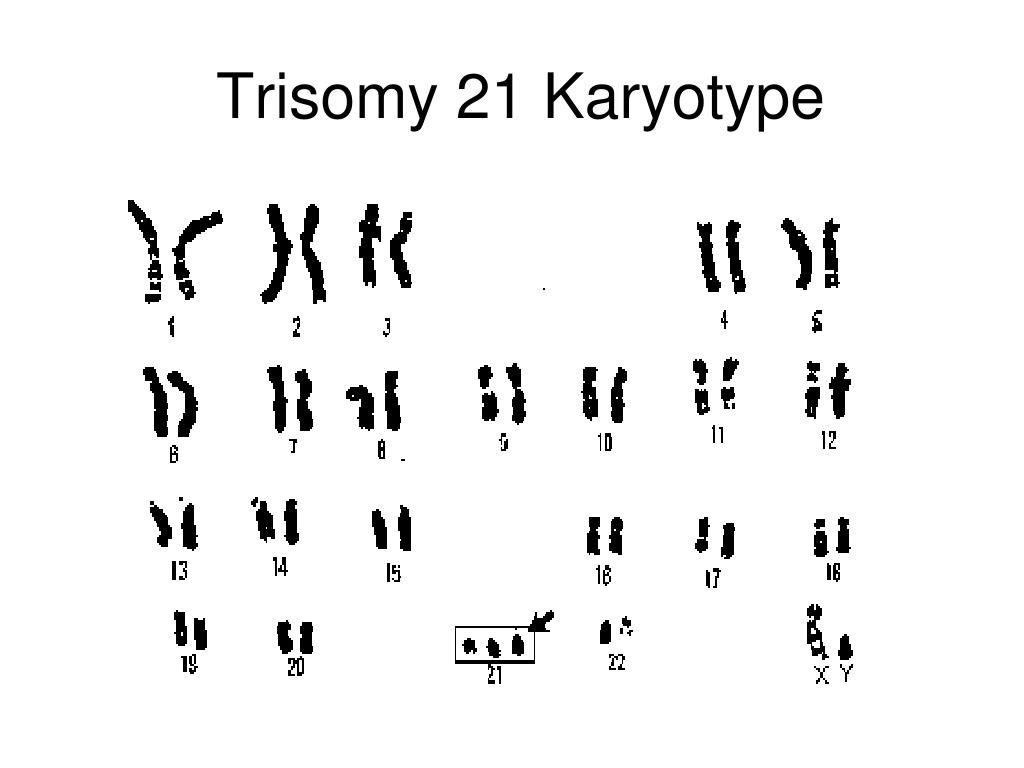 Trisomy 21 tests