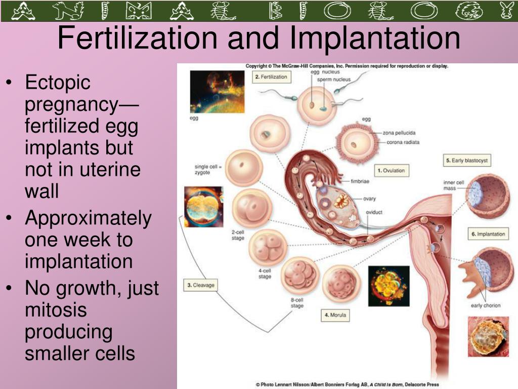 Recurring yeast infection while pregnant