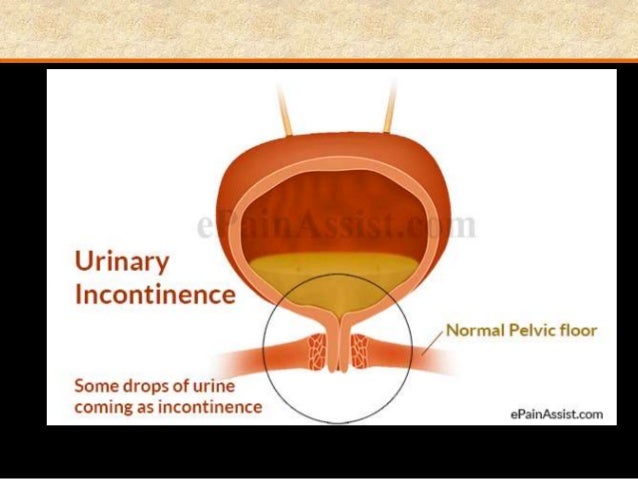 Urinary infection during pregnancy