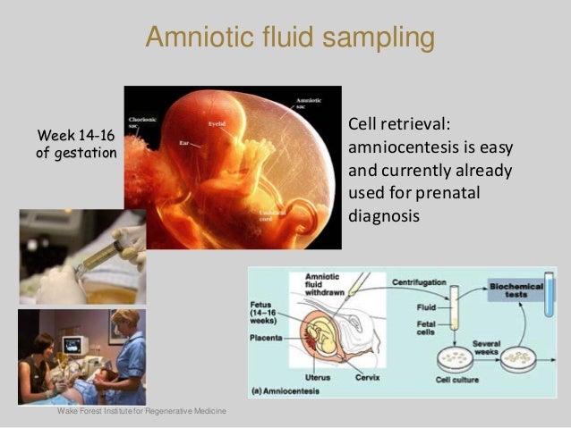 Cvs amniotic fluid test