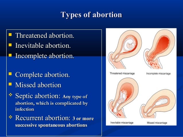 What to expect miscarriage